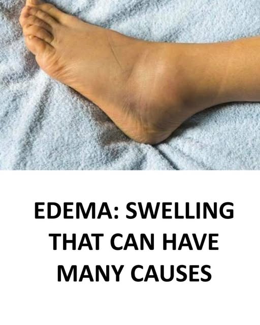 568305782 843239601728244 4321400451903493986 N